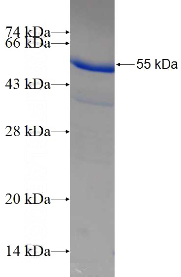 Recombinant Human STX17 SDS-PAGE
