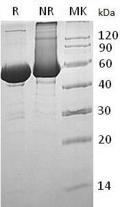 Human BPI (His tag) recombinant protein