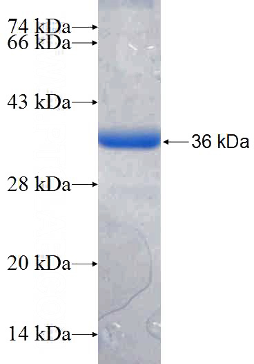 Recombinant Human SGSM3 SDS-PAGE