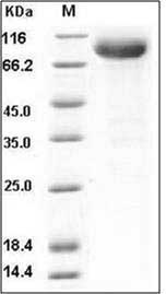 Mouse IL-13Ra1 Protein (His & Fc Tag) SDS-PAGE