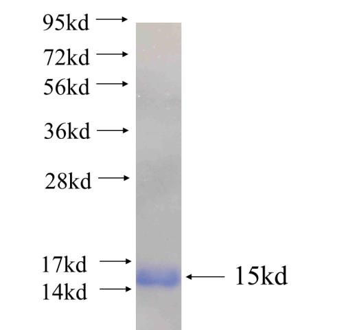 Recombinant human ZDHHC23 SDS-PAGE