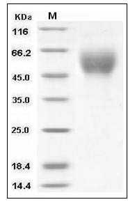 Human CD200R1 / CD200R Protein (His Tag) SDS-PAGE