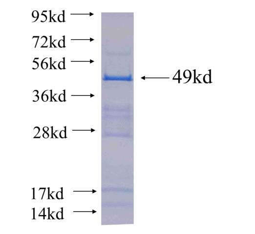 Recombinant human GALT(Full length) SDS-PAGE