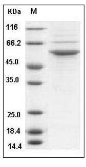 Human STK24 / MST3 Protein (His Tag) SDS-PAGE