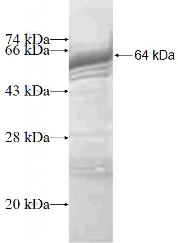 Recombinant Human ENC1 SDS-PAGE