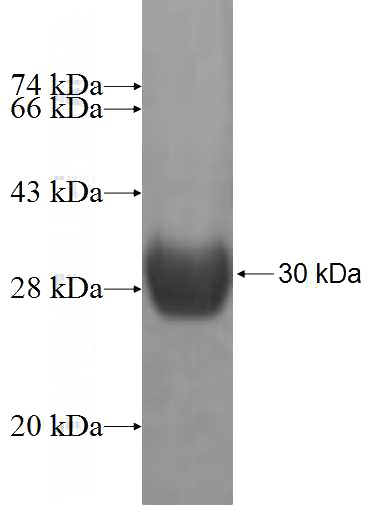Recombinant Human CINP SDS-PAGE