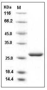 Human LYPLA2 / APT-2 Protein (His Tag) SDS-PAGE