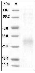 Human Sclerostin / SOST Protein (His Tag) SDS-PAGE