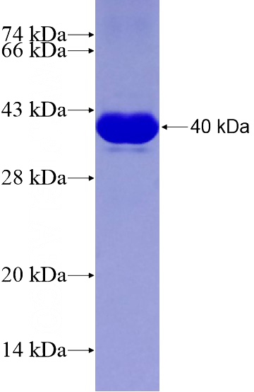 Recombinant Human AMER1 SDS-PAGE