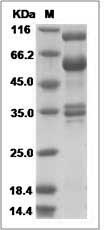 Canine HGF / Hepatocyte Growth Factor Protein SDS-PAGE