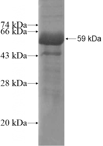 Recombinant Human ZC3HAV1L SDS-PAGE