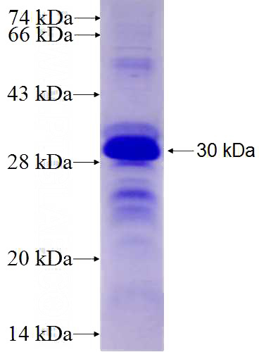 Recombinant Human LRP6 SDS-PAGE