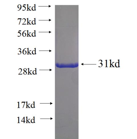 Recombinant human NPHP1 SDS-PAGE