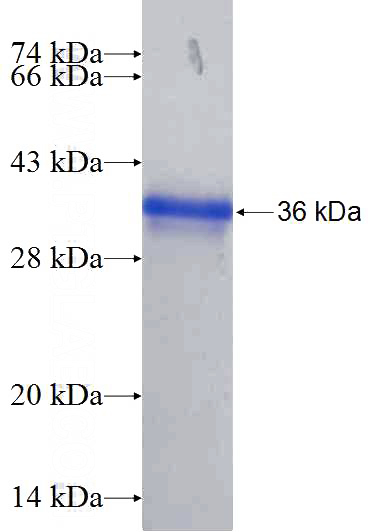 Recombinant Human AREG SDS-PAGE