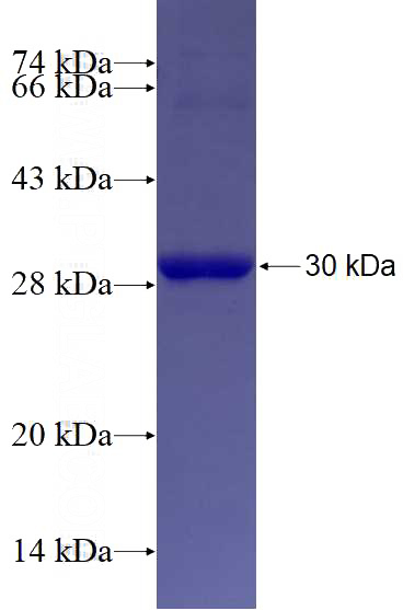 Recombinant Human THBS1 SDS-PAGE