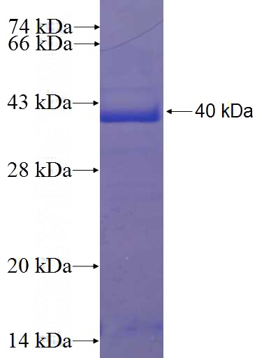 Recombinant Human SRRD SDS-PAGE
