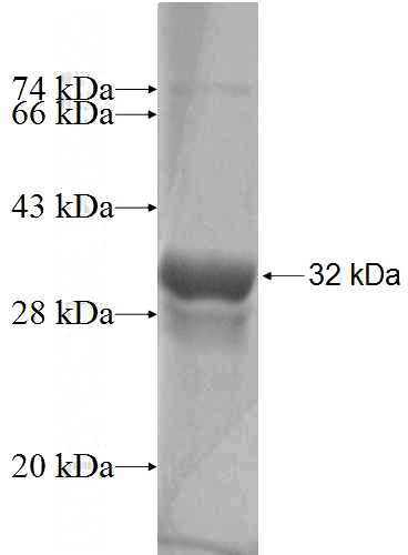 Recombinant Human LSM6 SDS-PAGE