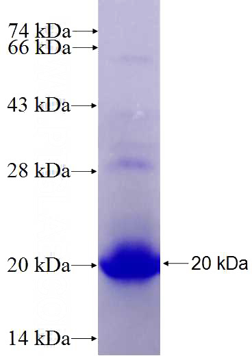 Recombinant Human PLZF SDS-PAGE