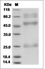 Influenza A H5N1 (A/chicken/Yamaguchi/7/2004) Hemagglutinin / HA Protein (His Tag)