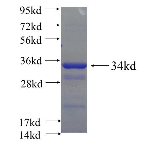 Recombinant human PHOX2B SDS-PAGE