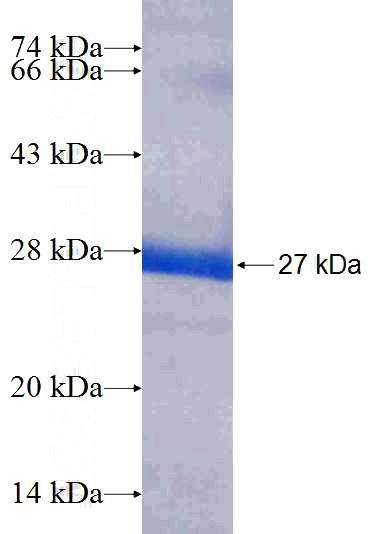 Recombinant Human MRPS10 SDS-PAGE