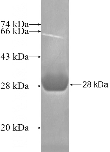 Recombinant Human SLC25A23 SDS-PAGE
