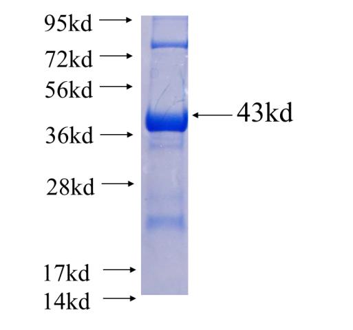 Recombinant human SCAMP2 SDS-PAGE