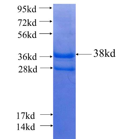 Recombinant human LAPTM4B SDS-PAGE