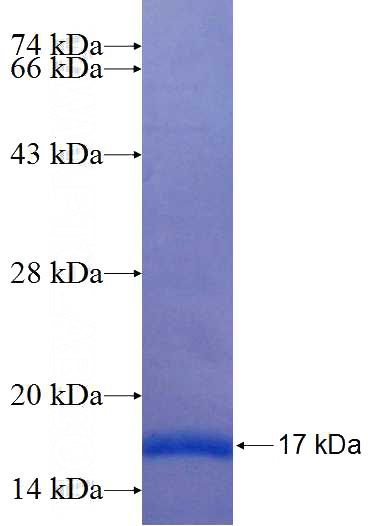 Recombinant Human TAF5 SDS-PAGE