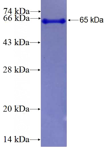 Recombinant Human TIAM2 SDS-PAGE
