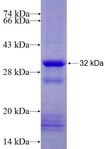 Recombinant Human MARCO SDS-PAGE