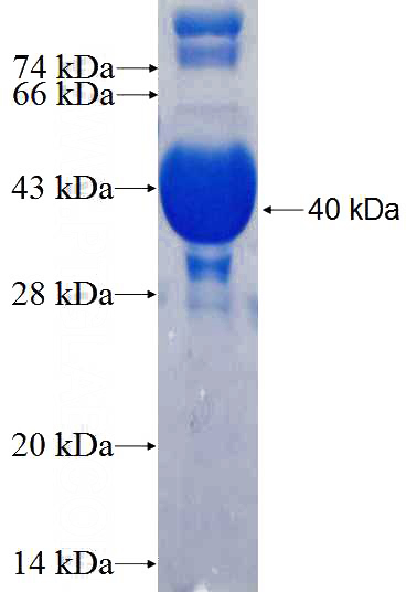 Recombinant Human KIFC2 SDS-PAGE