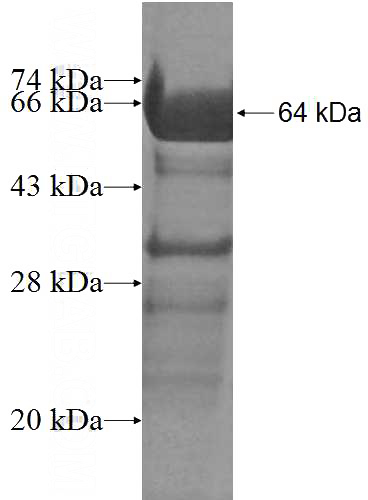 Recombinant Human SF4 SDS-PAGE