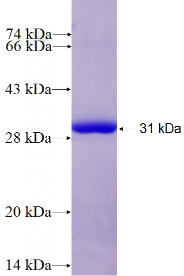 Recombinant Human LRRC48 SDS-PAGE