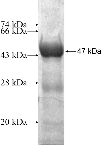 Recombinant Human FAM160B2 SDS-PAGE
