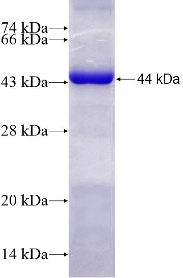 Recombinant Human DOCK2 SDS-PAGE