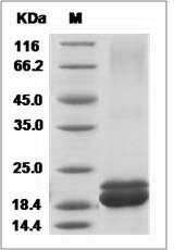 Human IFN-alpha / IFNA1 / IFN Protein (His Tag)