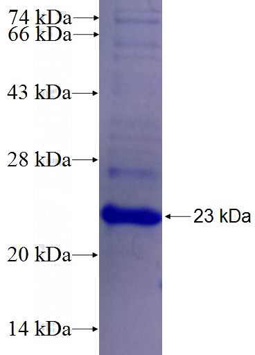 Recombinant Human NEUROD6 SDS-PAGE