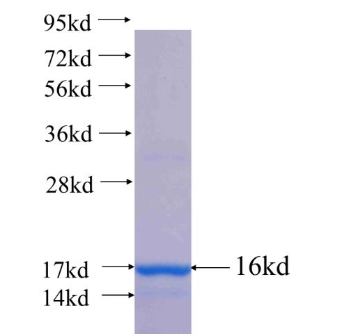 Recombinant human RAB7B SDS-PAGE