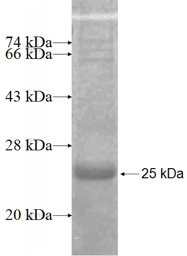 Recombinant Human IMMP1L SDS-PAGE