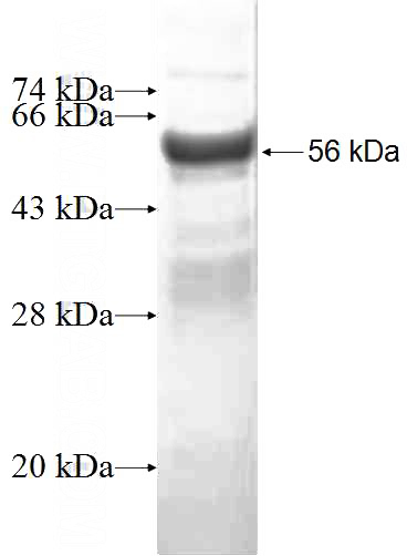 Recombinant Human CYTH2 SDS-PAGE