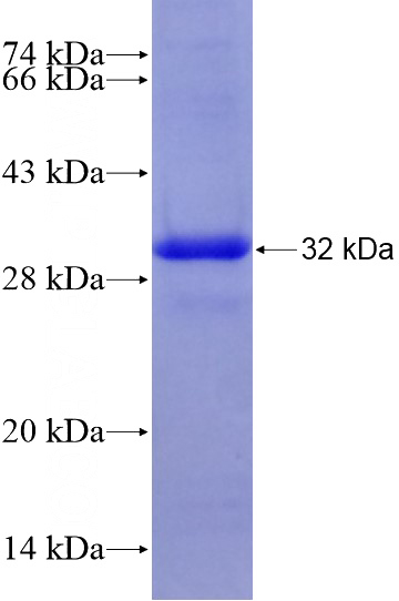 Recombinant Human ABCC6 SDS-PAGE