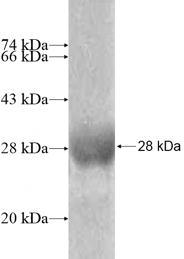 Recombinant Human MYL6B SDS-PAGE