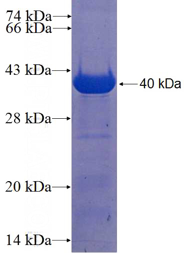 Recombinant Human C21orf91 SDS-PAGE