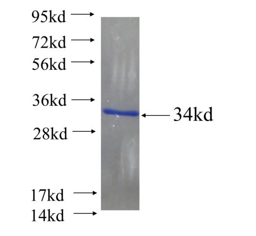 Recombinant human AADAC SDS-PAGE