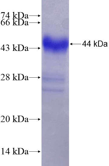Recombinant Human COL3A1 SDS-PAGE