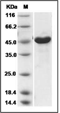 Novel coronavirus (HCoV-EMC/2012) Nucleoprotein / NP protein (His Tag) SDS-PAGE