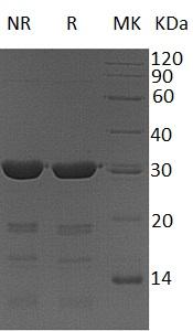 Human FKBP3/FKBP25 (His tag) recombinant protein