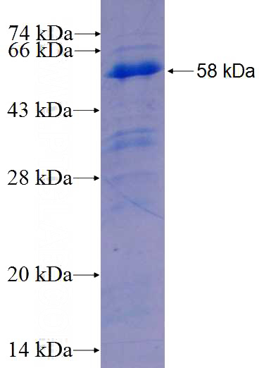 Recombinant Human SIPA1L2 SDS-PAGE
