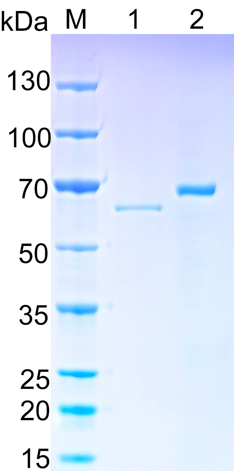 Recombinant Human STK31 SDS-PAGE